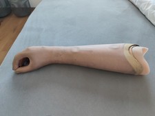 Prothese Otto Bock Unterarm