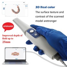 Dental Intraoral Scanner
