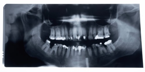Original dental ray - dental,