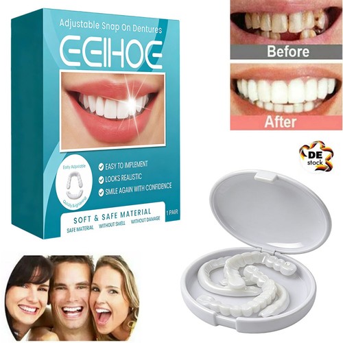 Snap veneers kosmetische - on,