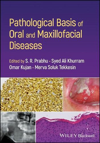 Pathological basis oral and - oral,