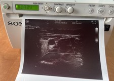 Sony UP-D898 MD Ultraschalldrucker ultrasound printer 