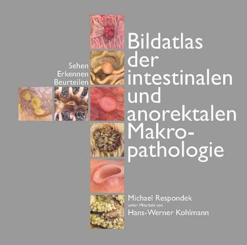Bildatlas der intestinalen und