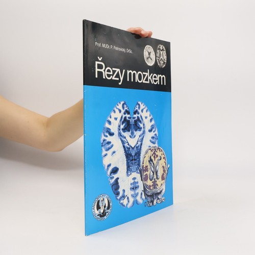řezy mozkem neuroanatomie - mozkem,
