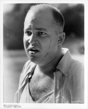 Mal Sondock with cut on his