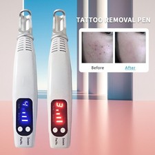 Picosecond Laser Tattoo Stift