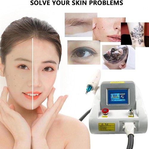 Yag laser - nd,