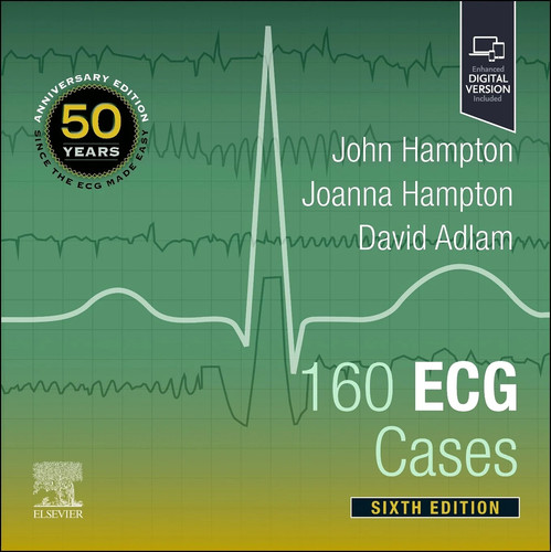 160 ecg cases - ecg,