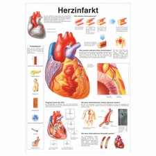 Herzinfarkt Poster Anatomie 70x50 cm medizinische Lehrmittel