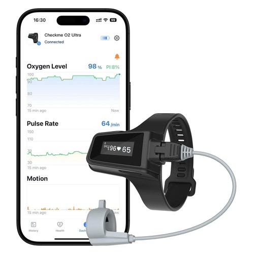 Wellue checkme ultra - wellue, o2
