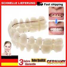 Snap On Veneers Kosmetische
