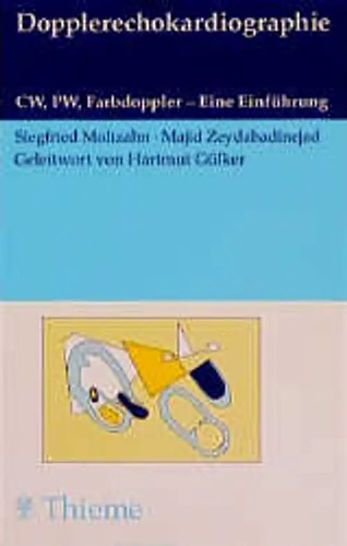 Dopplerechokardiographie cw - dopplerechokardiographie.,