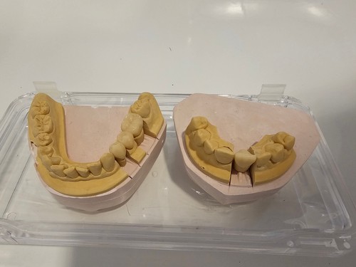 Zahntechnik dental - zahntechnik,