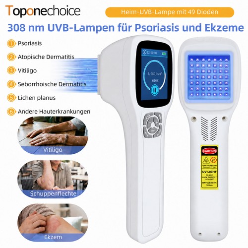 308nm uvb phototherapie lampe - uvb,
