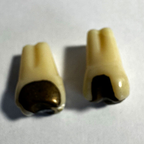 Dental kronen brücken teile - dental, kronen/brücken-teile