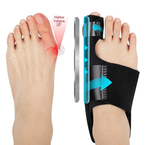 Hallux valgus korrektur - hallux,