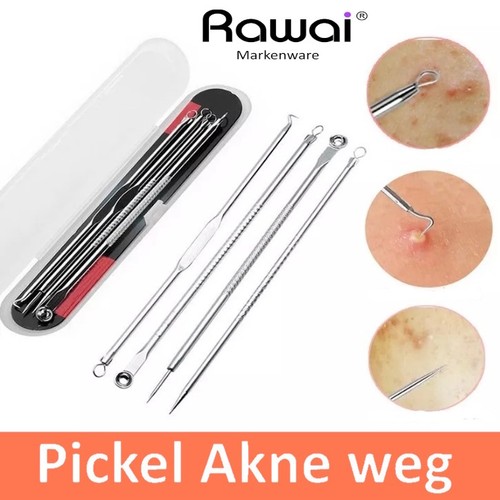 Pickel mitesser entferner - mitesser,