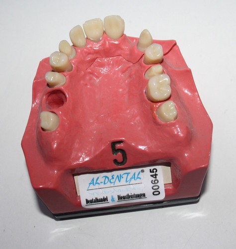 Dent schaumodell - schaumodell, 5