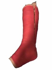 Gipsfuß/bein Cast SLC