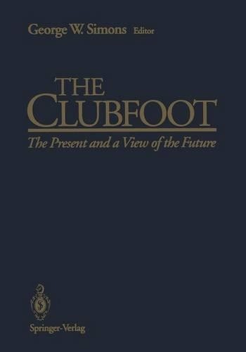 The clubfoot 9781461392712 - clubfoot,