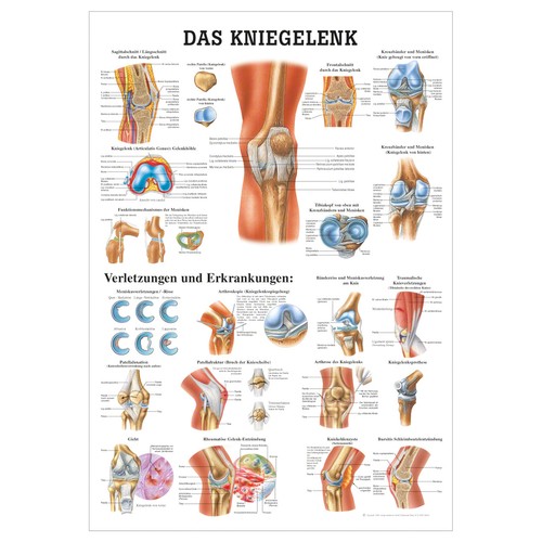 Das kniegelenk lehrtafel - kniegelenk,
