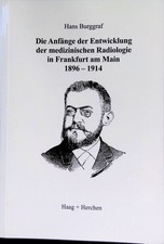 Die Anfänge der Entwicklung