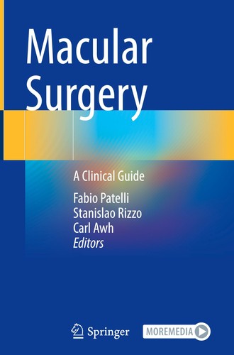 Macular surgery fabio - surgery, patelli