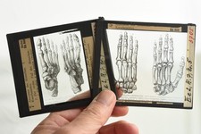 Alt Glasdia | Hand Fuß Hände Füße Anatomie Lehrmittel Medizin, Foto Bild Vintage