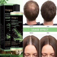 HOEGOA