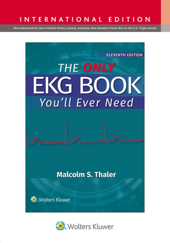 The only ekg - the,