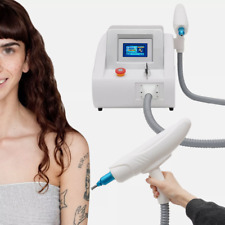 ND Yag Laser Tattooentfernung