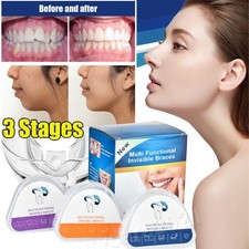 Zahnspange-Dental-Brace-3X-Ret
