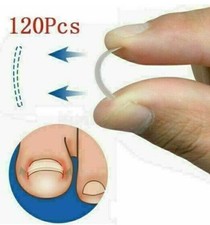 120x Eingewachsener Zehnagel