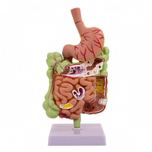 Pathologisches kolonmodell - pathologisches,