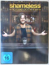Shameless - Die komplette