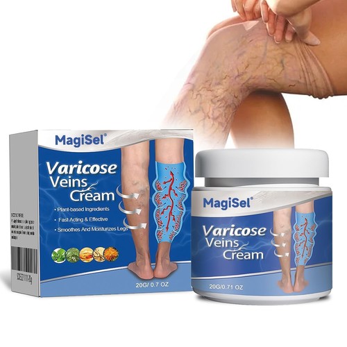 Venensalbe varicose veins - varicose,