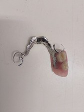 Zahnprothese Oberkiefer  Gebiss. #29