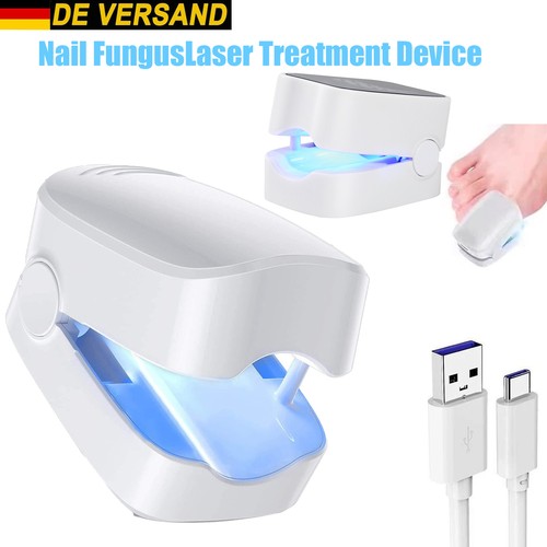 Laser nagelpilz fungal nail - laser,
