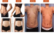 UNISEX Slim Patch Bauch