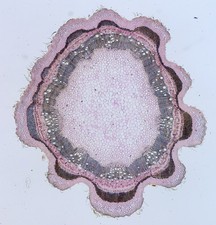 Antike Mikroskopfolie von Watson. Abschnitt der Mimose nilotica. Arabischer Gummibaum.