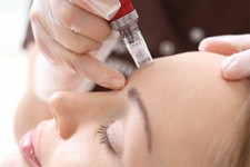 Schulung Selbststudium Microneedling mit  Zertifikat