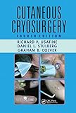 Cutaneous Cryosurgery: Principles and Clinical Practice